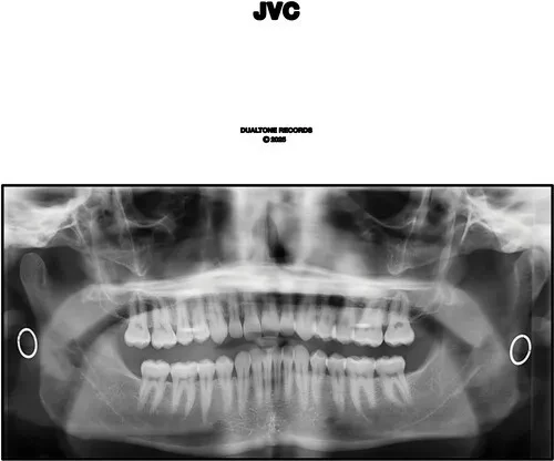 Виниловая пластинка Jack Van Cleaf - Jvc [New Vinyl LP] Explicit, Bonus Tracks
