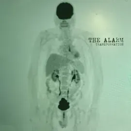 Виниловая пластинка The Alarm – Transformation 2026